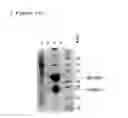 Fig. 12 - Method for extraction and purification of recombinant proteins from transgenic plants