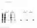 Fig. 13 - Method for extraction and purification of recombinant proteins from transgenic plants