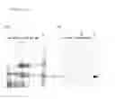 Fig. 14 - Method for extraction and purification of recombinant proteins from transgenic plants