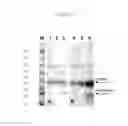 Fig. 03 - Calibrator/control for simultaneous assay of proteins capable of complexing with one another