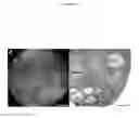Fig. 09 - INTERPENETRATING BIOMATERIAL MATRICES AND USES THEREOF