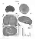 Fig. 16 - INTERPENETRATING BIOMATERIAL MATRICES AND USES THEREOF