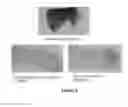 Fig. 04 - Hide processing methods and compositions