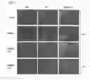 Fig. 08 - METHOD FOR INDUCING DIFFERENTIATION INTO EPITHELIAL PROGENITOR CELL/STEM CELL POPULATION AND CORNEAL EPITHELIAL CELL POPULATION FROM INDUCED PLURIPOTENT STEM CELLS