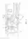 Fig. 04 - Dual contact beam terminal