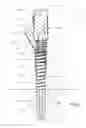 Fig. 06 - Dust shroud for power tools