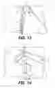 Fig. 10 - Trampoline and cage ball game device