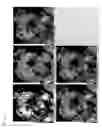 Fig. 07 - Porous composite metal oxide, catalyst using the same, and methods for producing the porous composite metal oxide and the catalyst