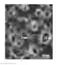 Fig. 01 - NANOCRATER CATALYST IN METAL NANOPARTICLES AND METHOD FOR PREPARING THE SAME
