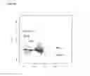 Fig. 05 - DIAGNOSTIC TRANSCRIPTOMIC BIOMARKERS IN INFLAMMATORY CARDIOMYOPATHIES