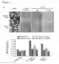 Fig. 08 - RAF gene fusions