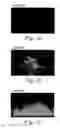 Fig. 03 - Methods of inhibiting and treating bacterial biofilms by metal chelators