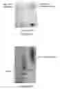 Fig. 08 - Von Willebrand factor- and factor VIII-polymer conjugates having a releasable linkage