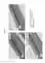 Fig. 06 - Methods for treating diseases of the retina