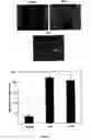 Fig. 04 - COMPOSITIONS FOR PREVENTING, REDUCING OR TREATING KERATINOCYTE-MEDIATED INFLAMMATION