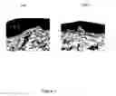 Fig. 04 - Use of PUFAs for treating skin inflammation