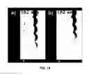 Fig. 19 - Protein renaturation microfluidic devices and methods of making and using the same