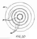 Fig. 06 - APPLICATOR FOR USE IN A BRACHYTHERAPY RADIATION TREATMENT