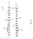 Fig. 04 - Radiopaque cannula marker