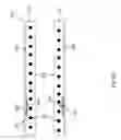 Fig. 06 - Radiopaque cannula marker