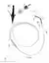 Fig. 15 - Radiopaque cannula marker