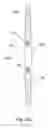 Fig. 35 - System for introducing a pelvic implant