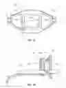 Fig. 07 - Mouthpiece and methods of use of same
