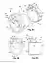 Fig. 06 - Endoscopic sheath assembly