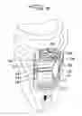 Fig. 10 - Expandable surgical access port