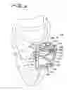 Fig. 09 - Expandable surgical access port