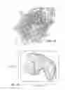 Fig. 04 - COLLAPSIBLE BARRIER FOR ORGAN RETENTION AND METHOD OF USE