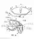 Fig. 18 - COLLAPSIBLE BARRIER FOR ORGAN RETENTION AND METHOD OF USE