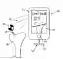 Fig. 01 - Integrated surgical device combining instrument, tracking system and navigation system