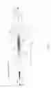 Fig. 08 - Laser trabeculectomy with energy dissipating injection