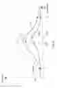 Fig. 09 - Laser trabeculectomy with energy dissipating injection
