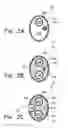 Fig. 04 - Coated balloon catheter