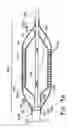 Fig. 06 - Coated balloon catheter
