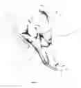 Fig. 05 - Methods and systems for treating plantar fascia