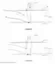 Fig. 08 - Methods and systems for treating plantar fascia