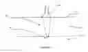 Fig. 10 - Methods and systems for treating plantar fascia