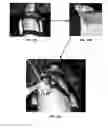 Fig. 27 - System and method useful for sarcomere imaging via objective-based microscopy
