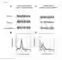 Fig. 06 - METHOD OF EVALUATING SUITABILITY FOR DRUG THERAPY FOR THE PREVENTION AND TREATMENT OF ANXIETY DISORDERS USING CHOLINERGIC TYPE II THETA RHYTHM
