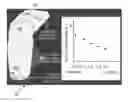 Fig. 01 - Measurement and use of in-socket residual limb volume change data for prosthetic fitting