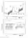 Fig. 11 - Measurement and use of in-socket residual limb volume change data for prosthetic fitting