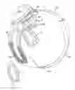 Fig. 01 - Method and apparatus for fitting a visual prosthesis using electrically evoked electroretinograms