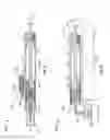 Fig. 12 - Vacuum assisted lancing system with elective vacuum release and method for blood extraction with minimal pain