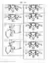 Fig. 10 - Assessment of Spinal Anatomy