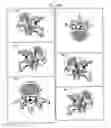 Fig. 13 - Assessment of Spinal Anatomy