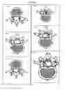 Fig. 14 - Assessment of Spinal Anatomy