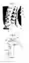 Fig. 19 - Assessment of Spinal Anatomy
